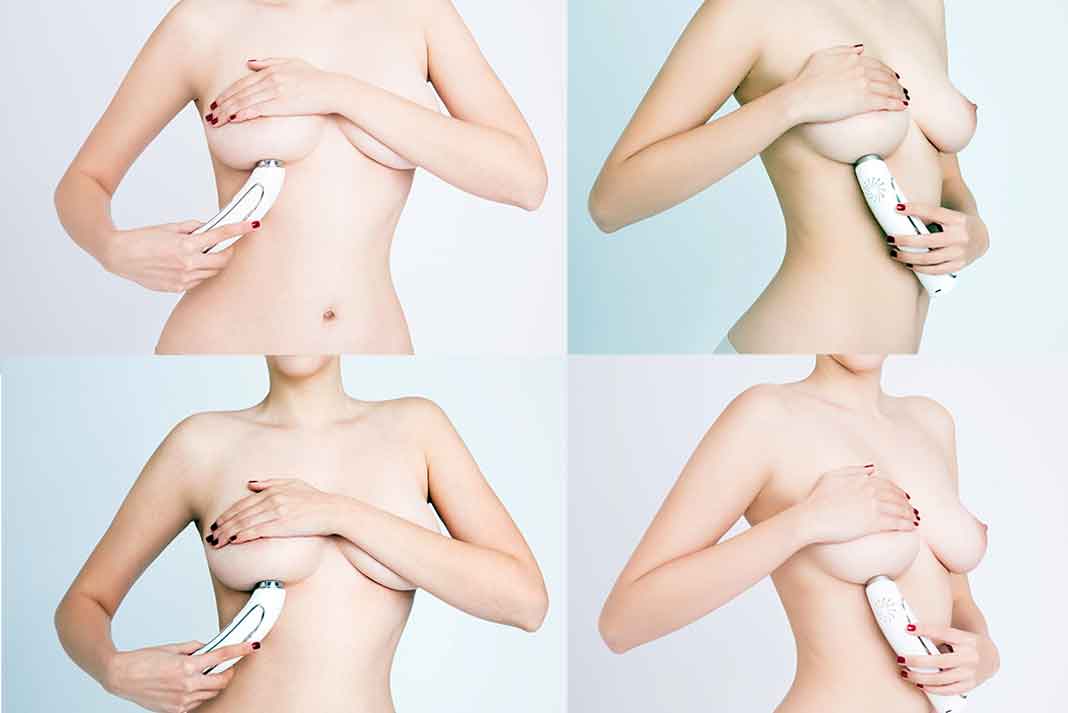 Esta es la forma como puedes colocar el Pink Luminouse Breast.